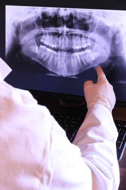 Best Emergency Treatment for Dental Infections or Abscesses in Mitchell, NE