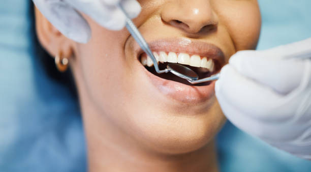 Best Emergency Tooth Extraction in Mitchell, NE