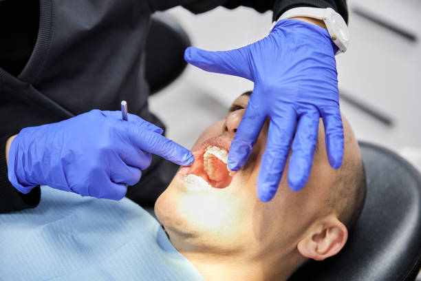 Best Emergency Tooth Extraction in Mitchell, NE